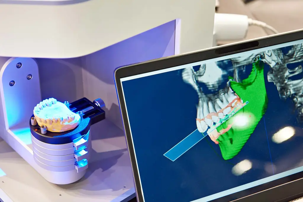 3D scan of a partial denture framework design Chrome Cast Dental Laboratory