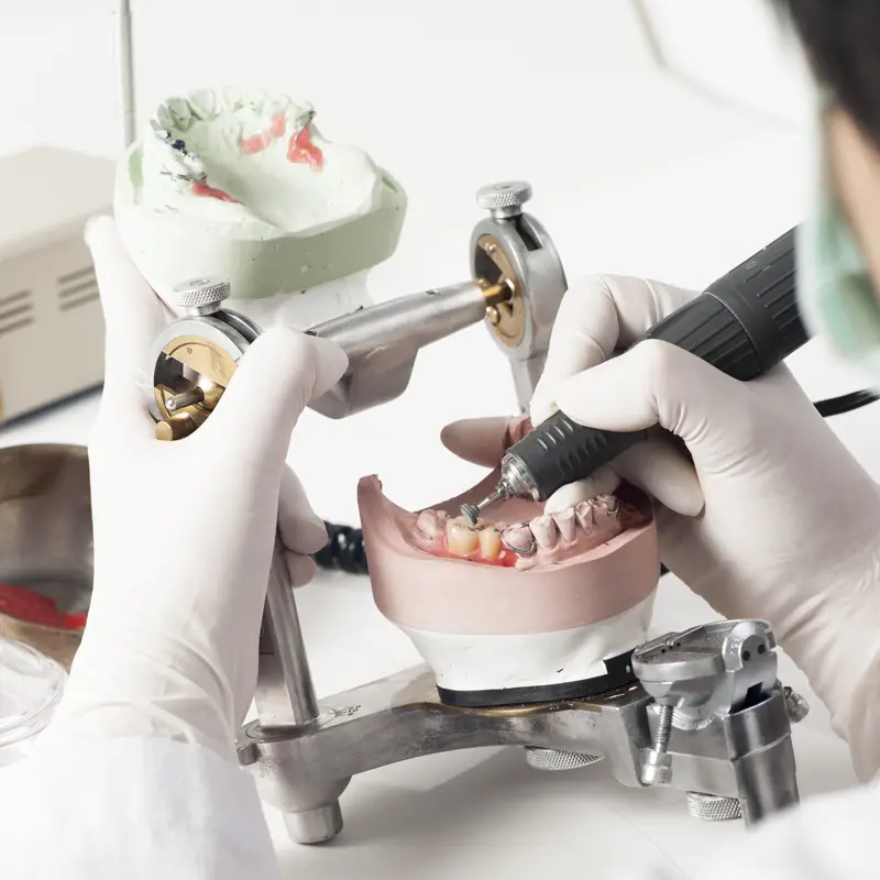 Denture models on an articulator in the Chrome Cast Dental Laboratory Crowborough