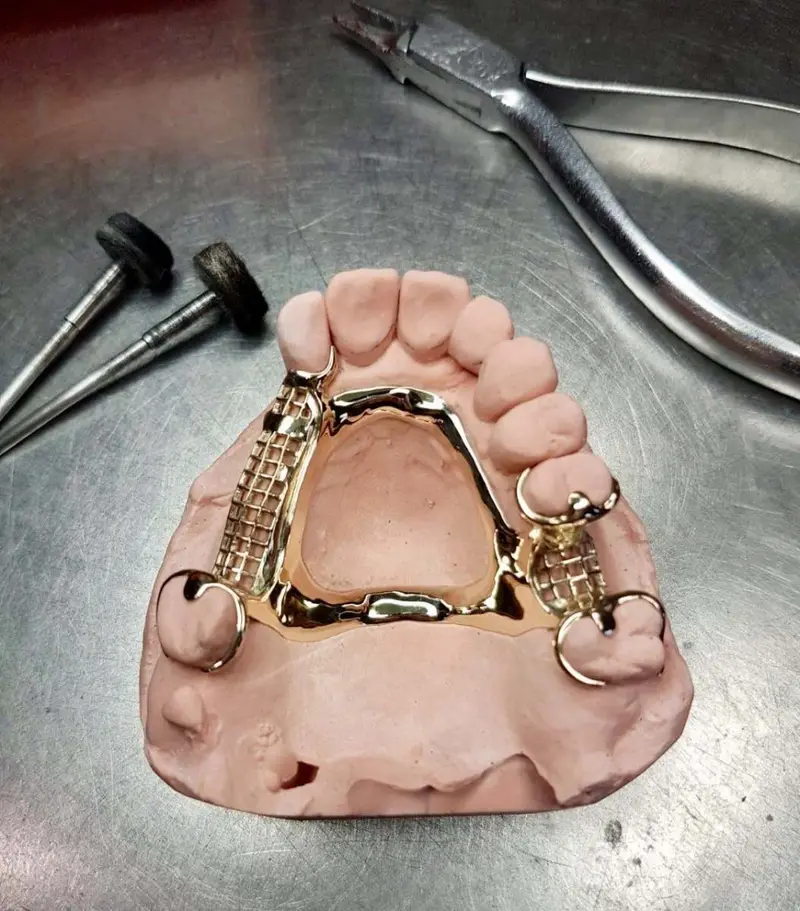 Chrome partial denture framework Chrome Cast Dental Laboratory East Sussex