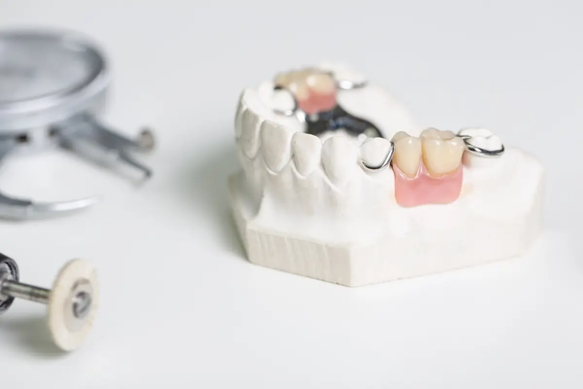 Chrome partial denture framework on a dental model Chrome Cast Dental Laboratory