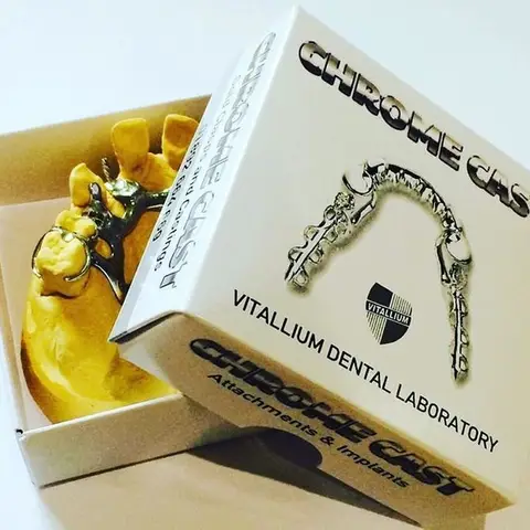 Denture and framework example 7 Chrome Cast Dental Laboratory East Sussex