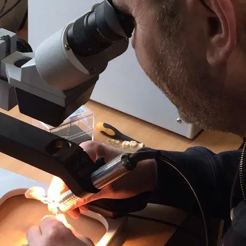 Denture and framework example 15 Chrome Cast Dental Laboratory East Sussex