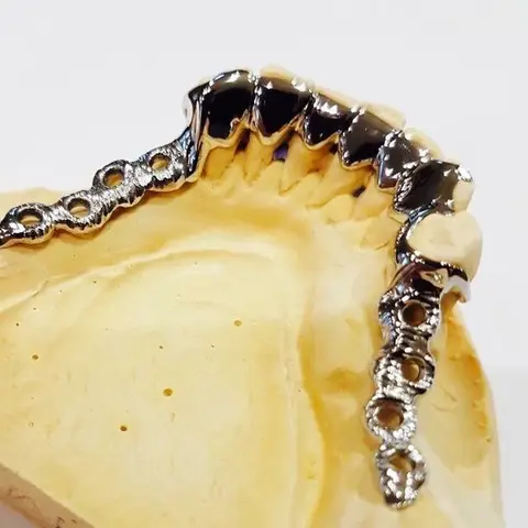 Denture and framework example 22 Chrome Cast Dental Laboratory East Sussex