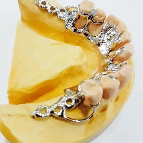 Denture and framework example 25 Chrome Cast Dental Laboratory East Sussex