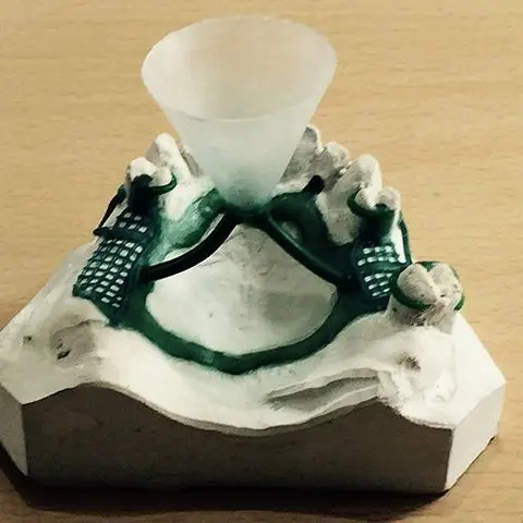 Denture and framework example 26 Chrome Cast Dental Laboratory East Sussex