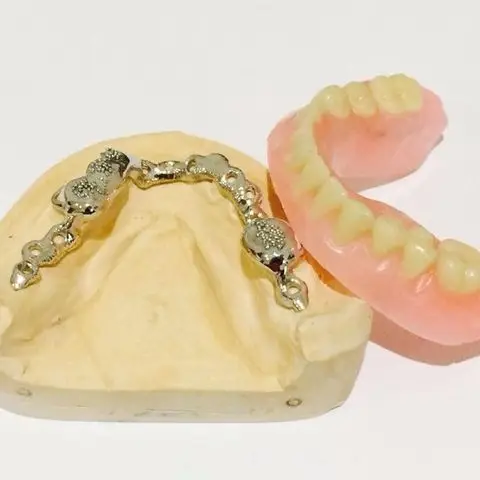 Denture and framework example 34 Chrome Cast Dental Laboratory East Sussex