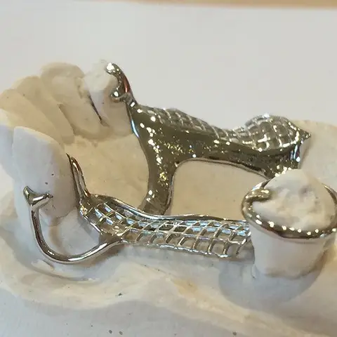 Denture and framework example 38 Chrome Cast Dental Laboratory East Sussex