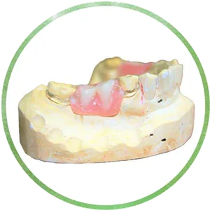 Clear Clasps Chrome Cast Dental Laboratory East Sussex