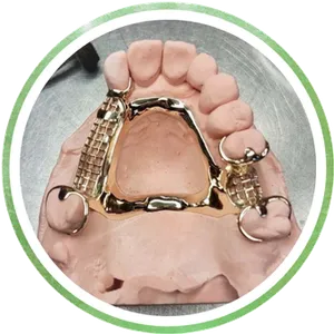 Gold Clasps and Castings Chrome Cast Dental Laboratory East Sussex